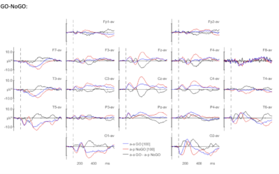 Why Event-Related Potentials (ERPs) Matter in qEEG Evaluations